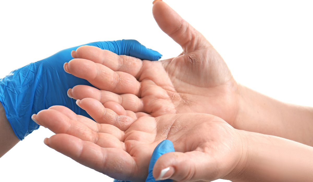 How to Clean Your House If You Have Contact Dermatitis